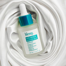 Load image into Gallery viewer, SERUM (anti aging &amp; prevent acne)
